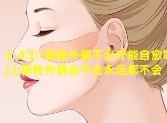 上 🦅 眼睑外翻不治疗能自愈吗(上眼睑外翻会不会永远都不会 🦄 恢复)